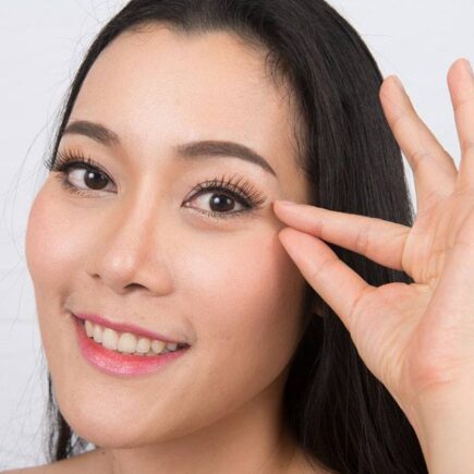 Double Eyelid Surgery