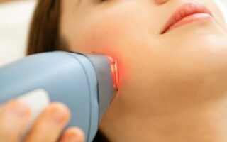 Laser Skin Treatments