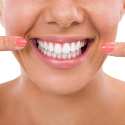 Are Porcelain Veneers As Strong As Teeth