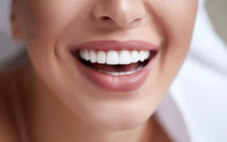 How Do You Keep Your Teeth Clean Under Veneers