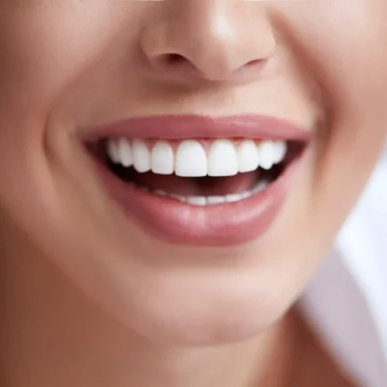 How Do You Keep Your Teeth Clean Under Veneers