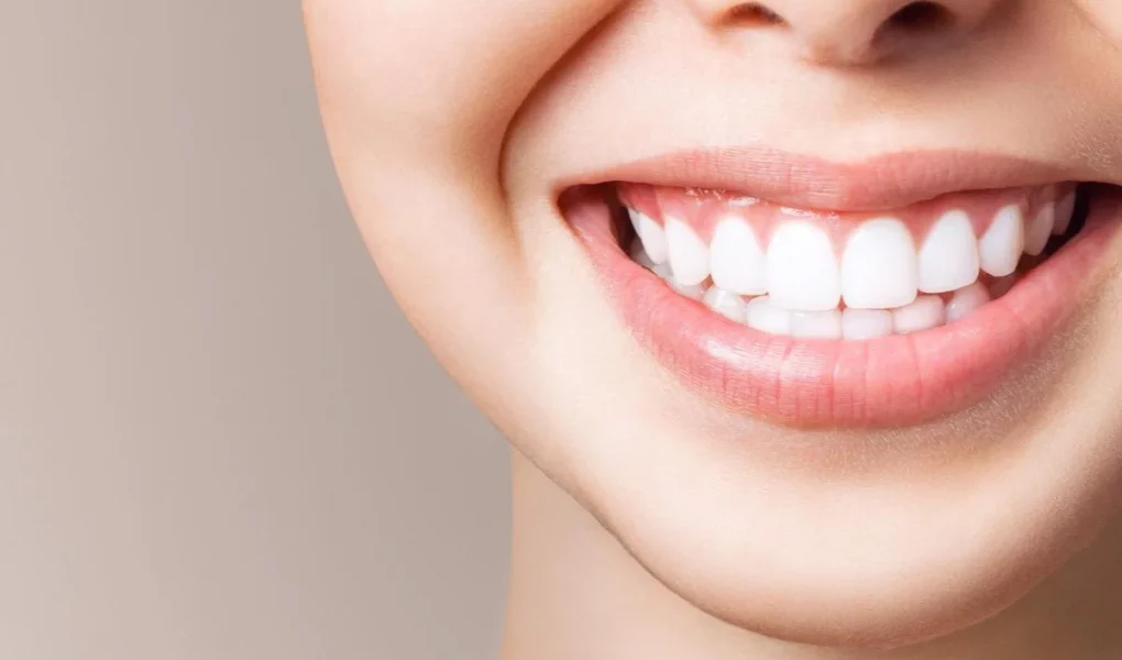Teeth Whitening A Complete Guide