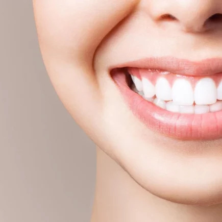 Teeth Whitening A Complete Guide