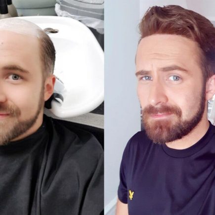 Wigs and toupees and their differences