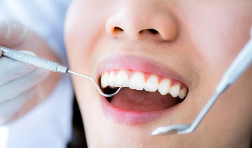 5 Weird Reasons Why Brits Dont Go to the Dentist