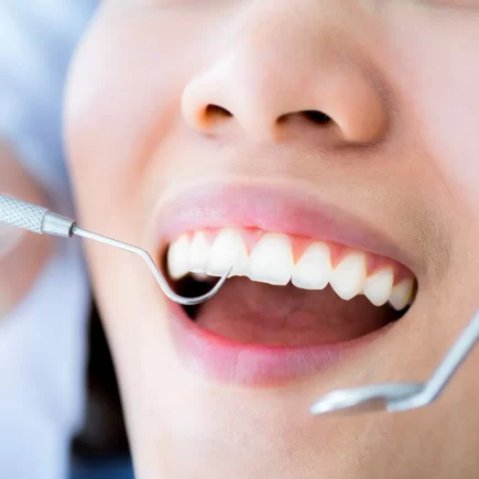 5 Weird Reasons Why Brits Dont Go to the Dentist