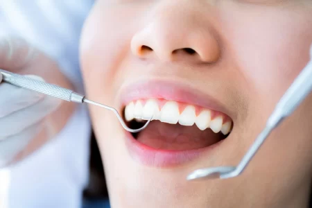 5 Weird Reasons Why Brits Dont Go to the Dentist
