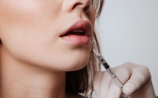 Getting Lip Fillers for Your Lips